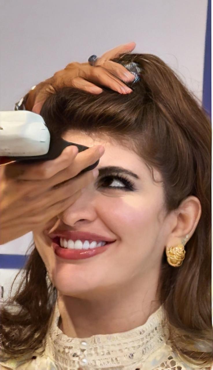 Ultrasound assessment of frontal region before botox treatment Dubai