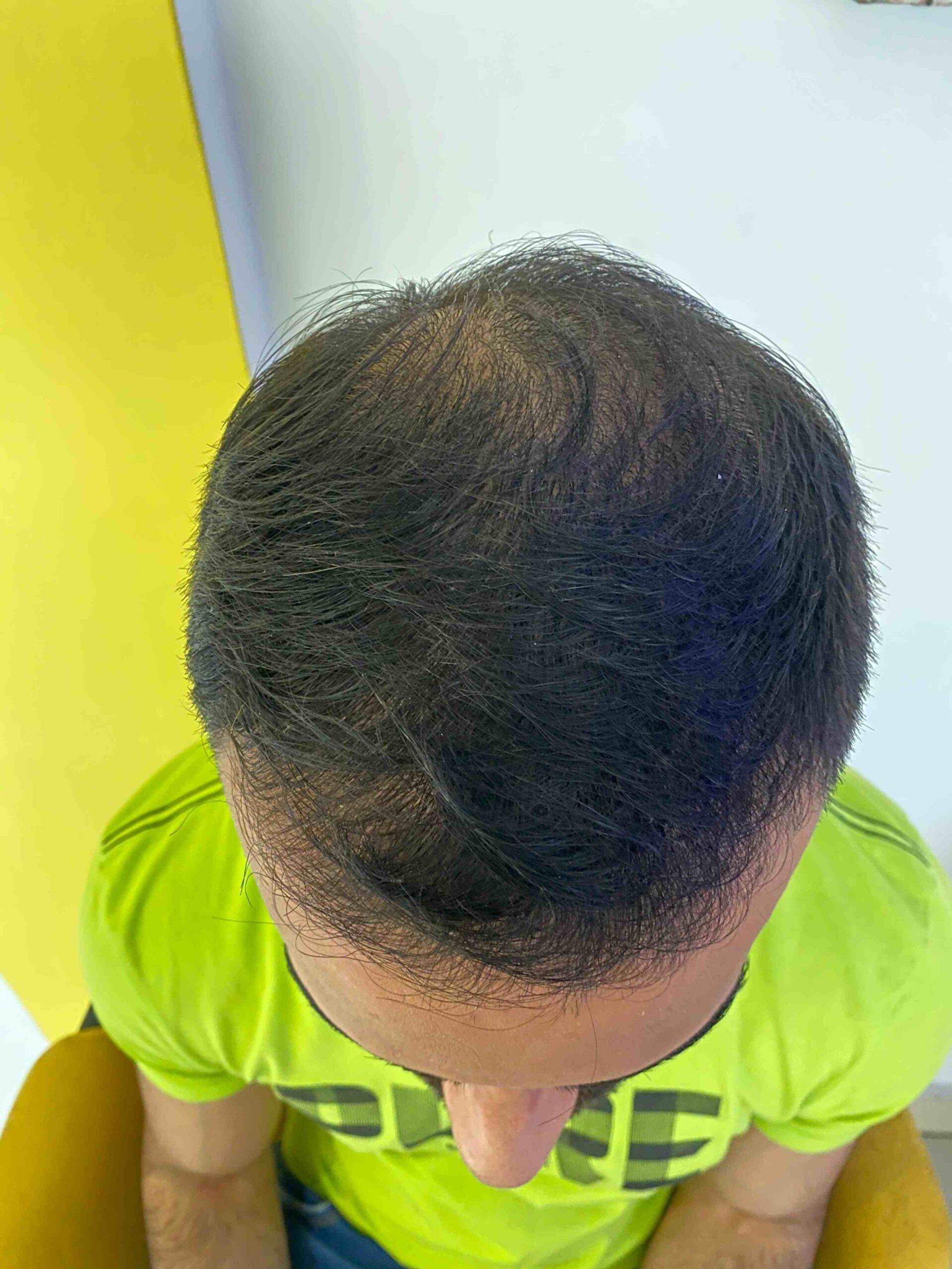 hair fter web