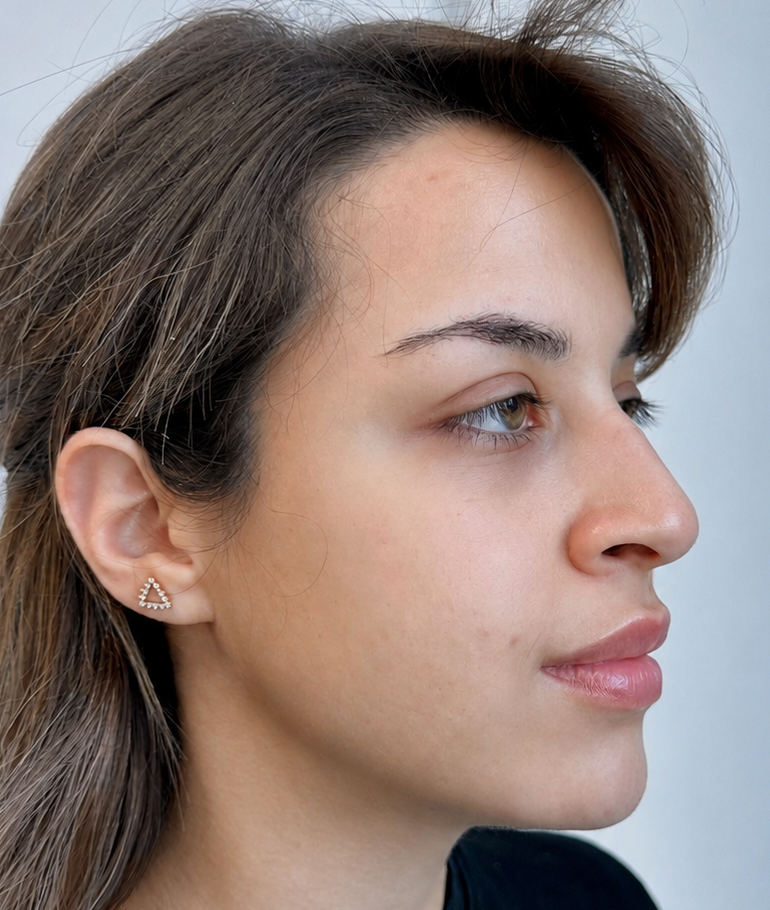 before facial contouring dr shiva