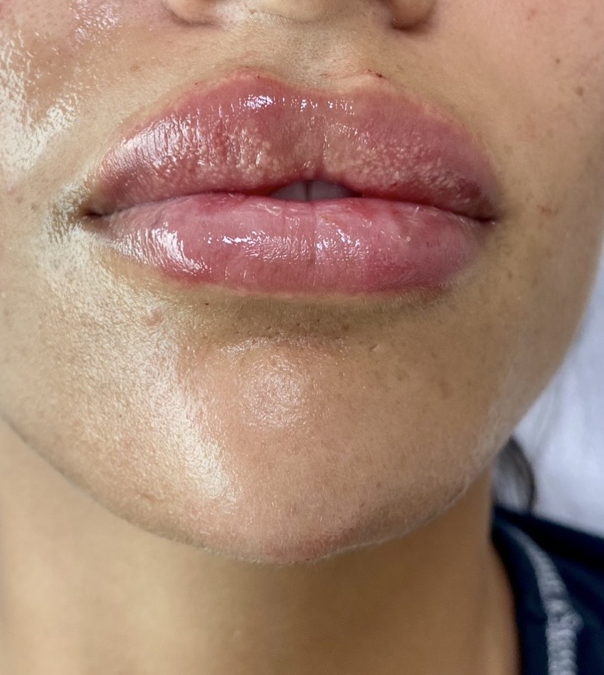 russian lips dr shiva