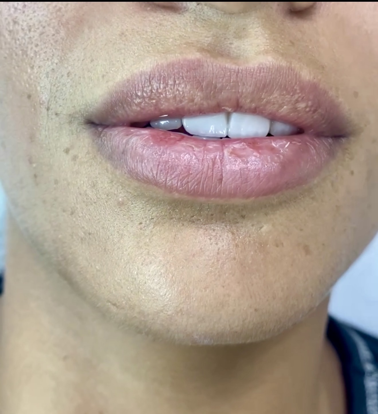 russian lips dr shiva